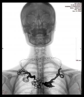 Francesca Gabrielli - Chernobyil 1986 - Fukushima 2011 - X-ray - necklace - 2011 .jpg