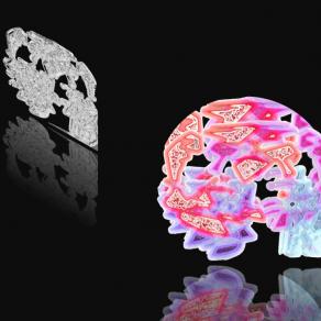 Tech Brain Targets Human Brain