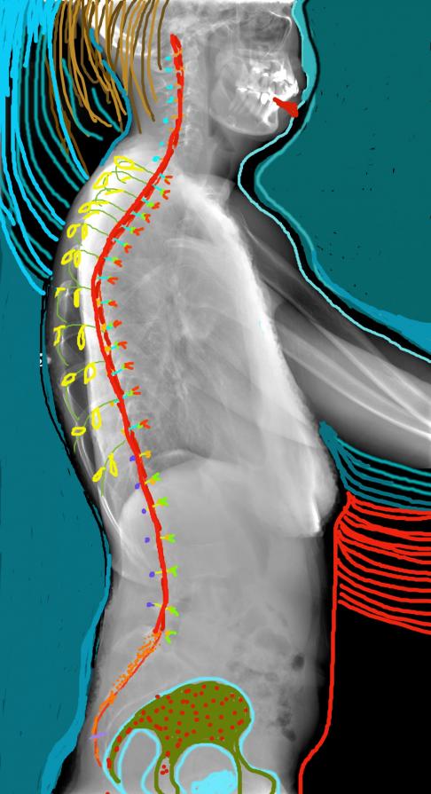 profile drawing on x-ray