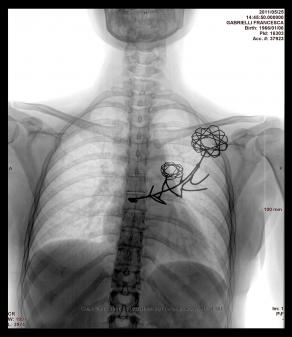 Francesca Gabrielli - Chernobyil 1986 - Fukushima 2011 - X-ray - brooche - 2011 .jpg