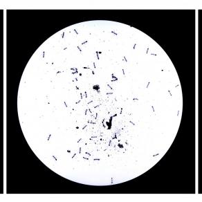 Syzygy 1/The Cygnus A Triptych