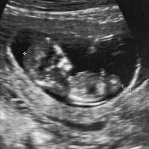 Personal Experience: A baby growing inside my body