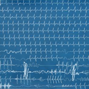 Medical data drawing-heart-rhythm